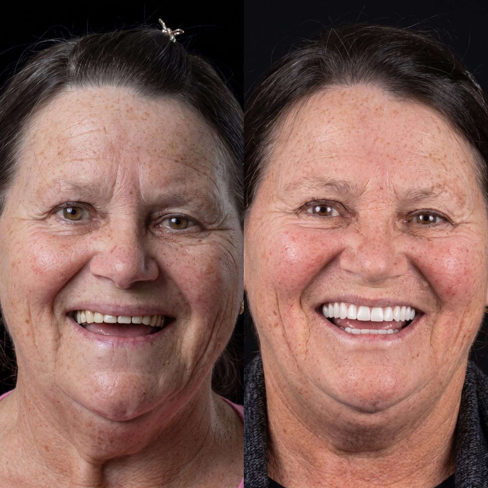 Resultado antes e depois 1