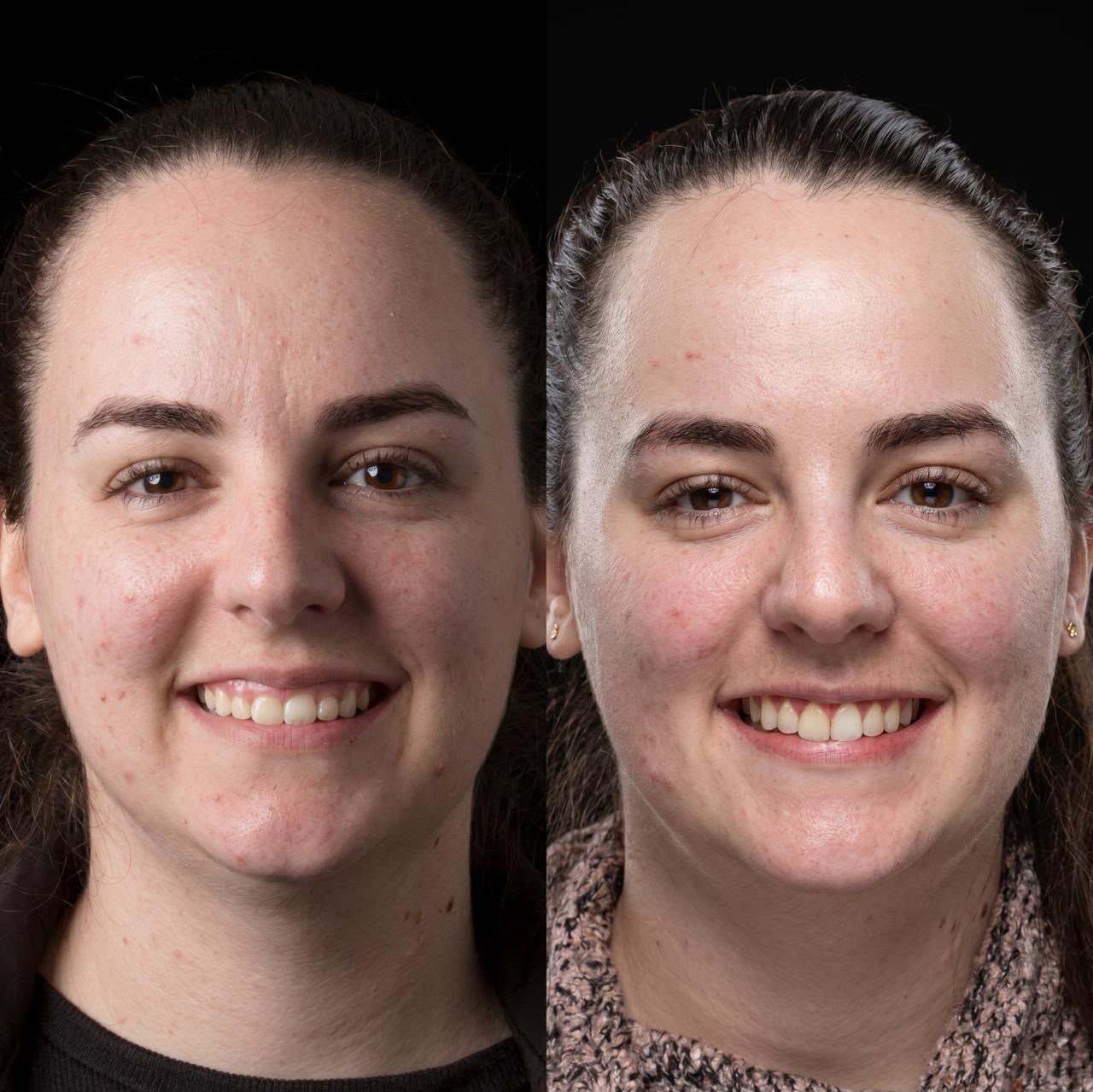 Resultado antes e depois 3